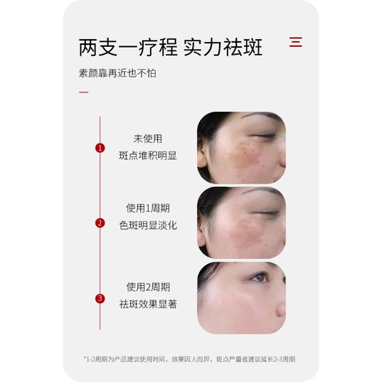 Advanced Freckle Whitening Cream Pore Minimizing Brightening Moisturizing Face Cream Dark Spot Corrector Lightweight Non-Greasy Formula Smooth Skin Tone Even Complexion Daily Skincare Solution Radiant Glow Enhancer - View 2 of 3