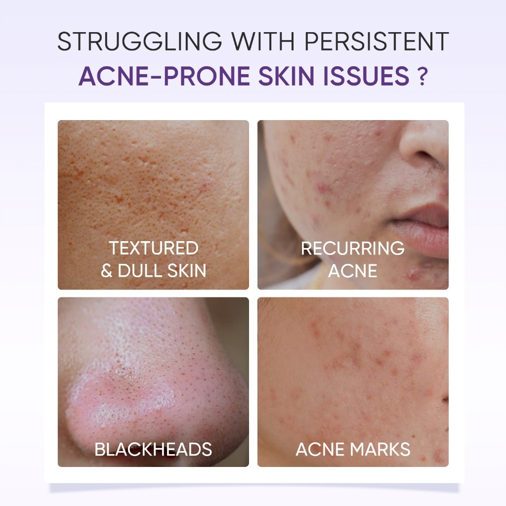 SKINTIFIC Lactic Acid Exfoliating Serum Skin Renewal Peeling Solution Acne Care Radiance Booster Brightening Face Serum Smooth Texture Pore Refining Lightweight Hydrating Daily Skincare - View 2 of 3