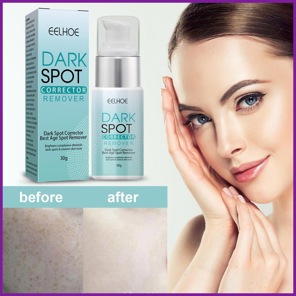 EELHOE Dark Spot Solution Advanced Brightening Serum Even Skin Tone Corrector Fade Spots Acne Marks Hyperpigmentation Repair Lightweight Hydrating Face Essence Glow Enhancing Daily Skincare - View 3 of 3