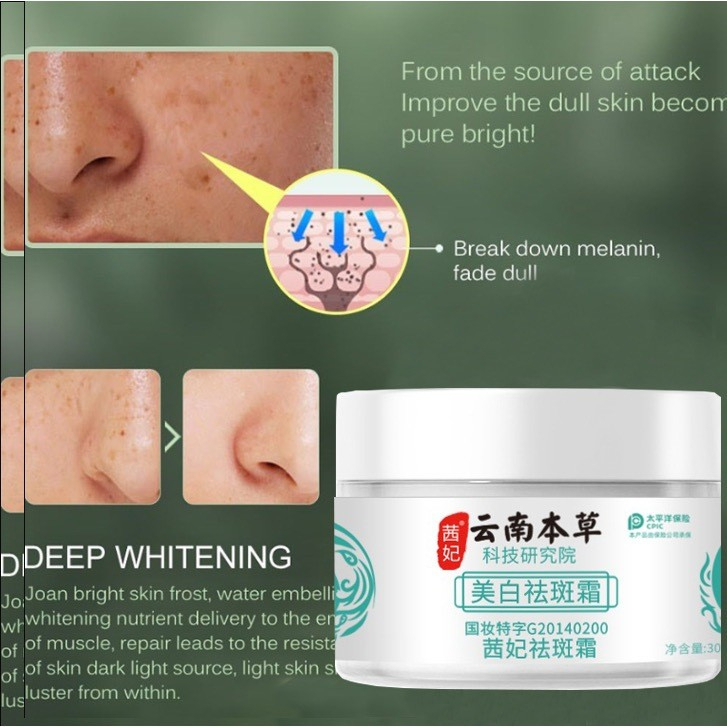 Yunnan Herbal Melasma Cream White Spot Cream 30g Face Moisturizer Freckle Removal Whitening Skin Care Cream for Dark Spots, Melasma, Uneven Skin Tone Brightening Daily Facial Treatment Herbal Formula Use - View 3 of 3