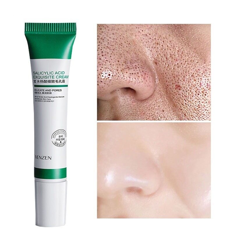 Salicylic Acid Pores Shrink Refining Cream Repair Large Open Pore Removal Black Dots Blackhead Acne Marks Facial Skin Care Serum Salicylic Acid Pores Shrink Refining Cream 水杨酸凝胶20g-1pcs (FROM MALAYSIA) - View 2 of 3