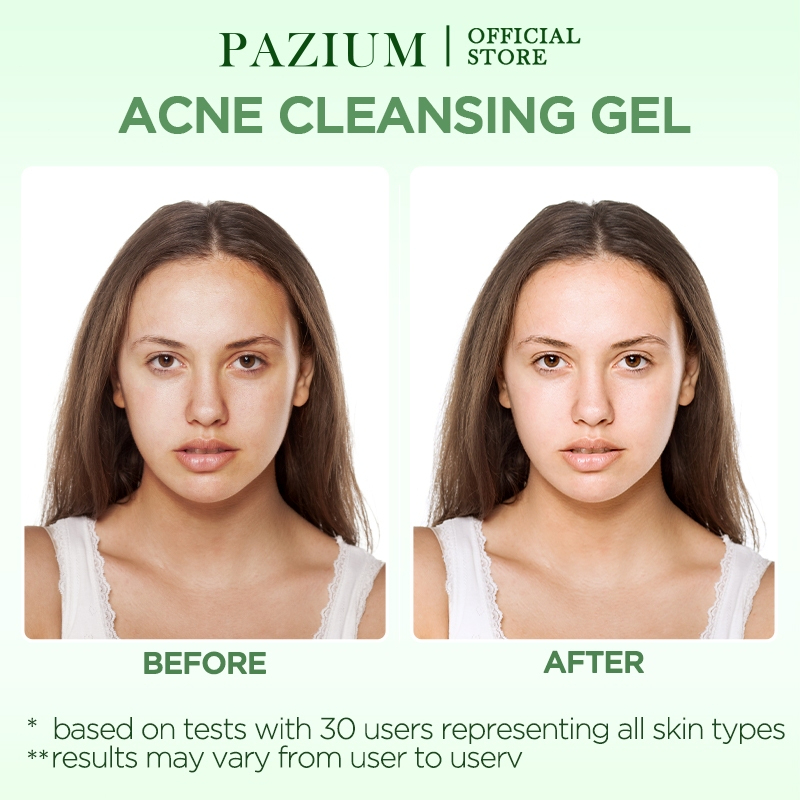 PAZIUM Acne Solution Cleansing Gel – Deep Hydrating Moisturizing Face Wash, Smoothing Skin Cleanser, Oil Control, Soothe & Purify Facial Gel for Clear, Healthy Skin - View 2 of 3