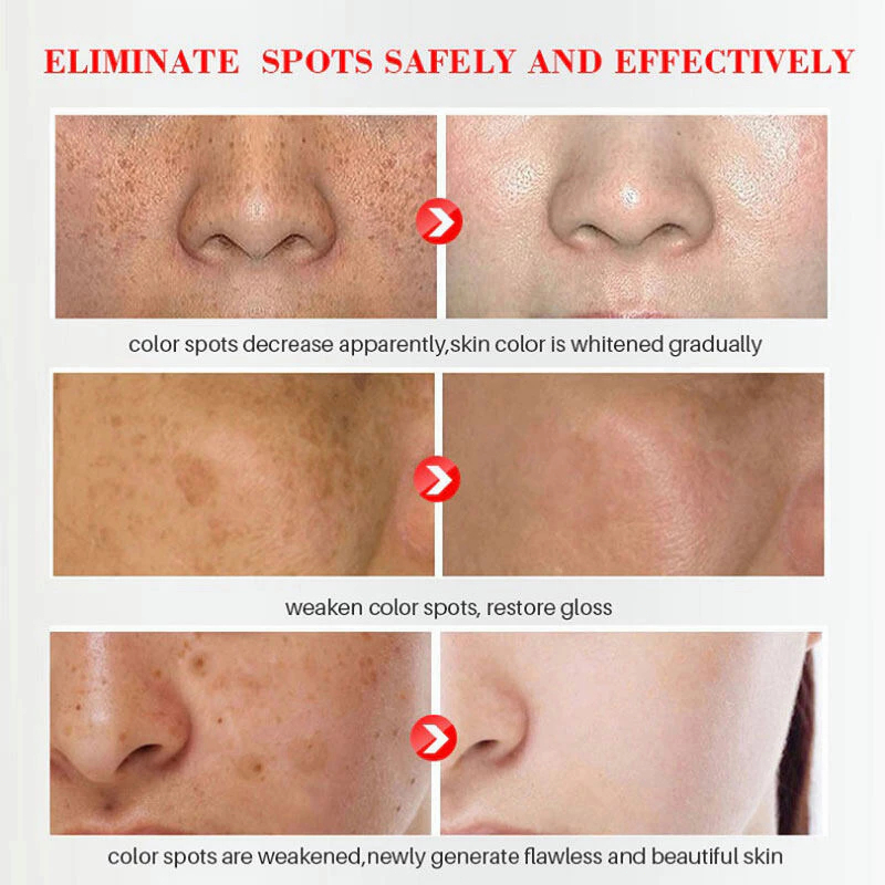 Papaya Scrub Cleanser 100g Exfoliating Gel Face Wash for Deep Pore Cleansing Removes Dead Skin Cells Blackheads Controls Oil Brightens Skin Leaves Face Smooth Fresh and Radiant Glow - View 2 of 3