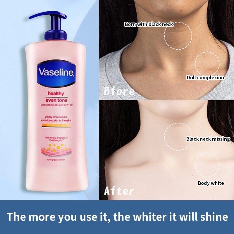 EMAZE - Vaseline Body Lotion 400ml, Original Vaseline Healthy Even Tone with Vitamin B3 and SPF 10 Non-greasy Lotion, Vaseline Healthy Even Tone Whiten Lotion-VS-PINK(FROM MALAYSIA) - View 3 of 3