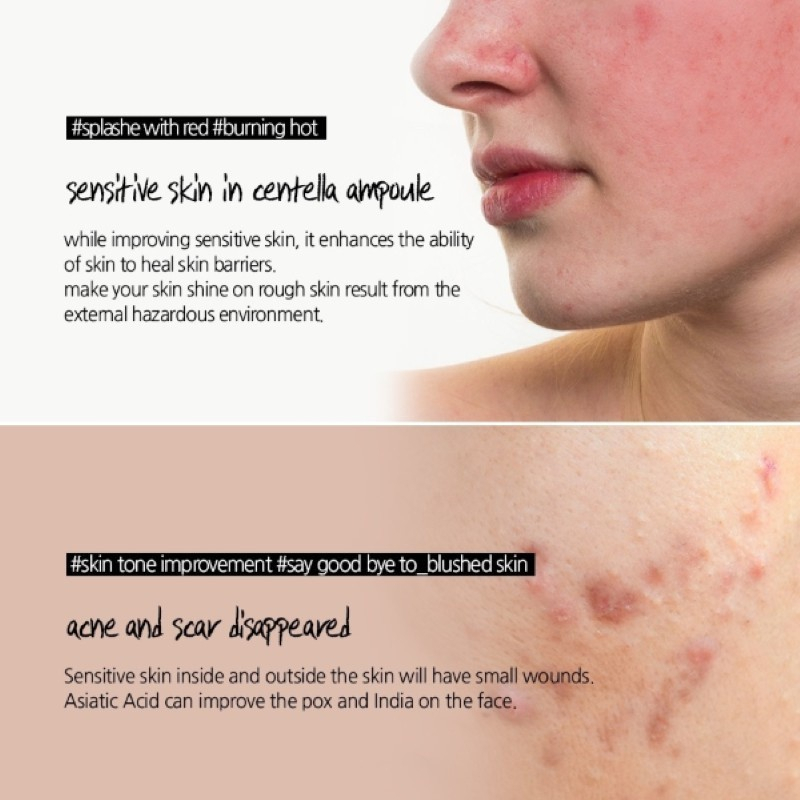 Madagascar Centella Asiatica Ampoule Facial Serum for Sensitive and Acne Prone Skin Soothing Hydrating Barrier Repair Treatment Reducing Redness Irritation Smoothing Texture Lightweight Daily Korean Skincare Care Solution - View 3 of 3
