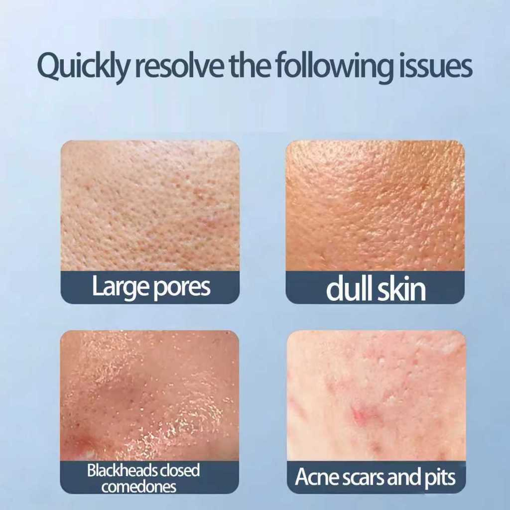 2% Salicylic Acid Serum 120ml Golden Concentration for Acne Blackheads and Closed Comedones Shrinks Pores Exfoliating Facial Serum Oil Control Skin Clearing Treatment Lightweight Fast Absorbing Dermatology Inspired Formula Solution -1pcs - View 2 of 3