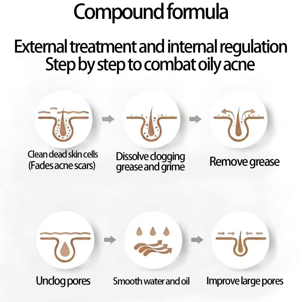 2% Salicylic Acid Serum 120ml Golden Concentration for Acne Blackheads and Closed Comedones Shrinks Pores Exfoliating Facial Serum Oil Control Skin Clearing Treatment Lightweight Fast Absorbing Dermatology Inspired Formula Solution -1pcs - View 3 of 3