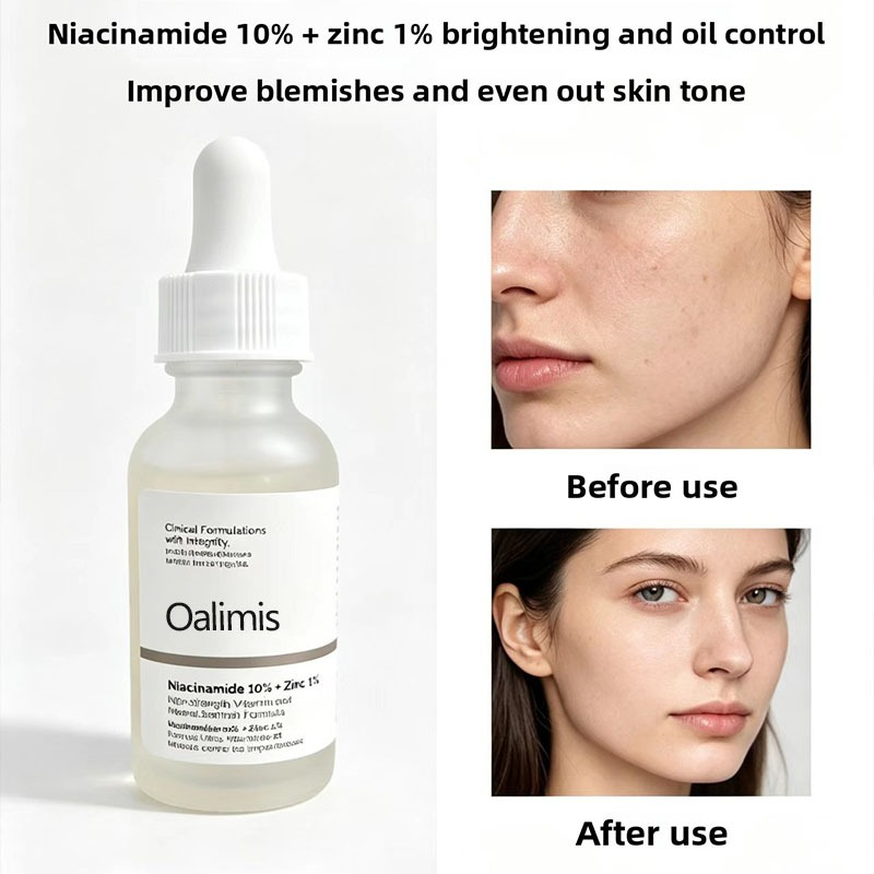Oalimis 10% Niacinamide + 1% Zinc Serum 30ml Hydrating Brightening Oil Control Pore Minimizing Acne Scar Reduction Facial Serum for Clear Skin Uneven Tone Sebum Control Lightweight Fast Absorbing Formula - View 2 of 3