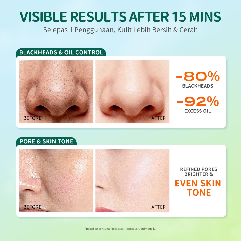 IROhada Mung Bean Brightening Anti Acne Clay Mask 50g Deep Cleansing Pore Minimizing Oil Control Facial Mask Hydrating Skin Care for Smooth Clear Radiant Healthy Looking Skin Daily Treatment - View 3 of 3