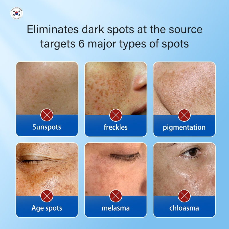 Dr.Ville Anti-Aging Fade Acne Whitening Cream Melasma Cream Pekas Remover Dark Spot Remover-1pcs - View 2 of 3