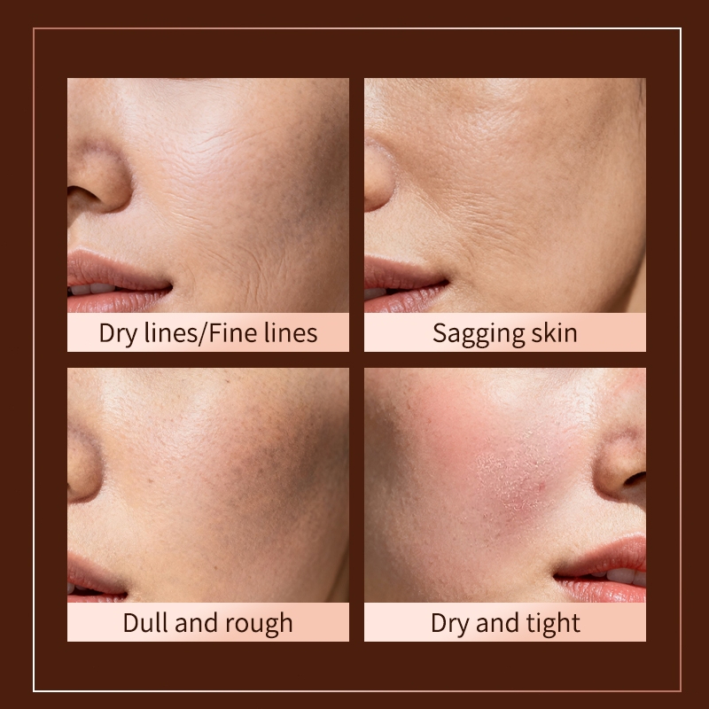 LYDIMOON Collagen Anti-Wrinkle Face Cream 60g | Anti-Aging, Reduces Fine Lines & Wrinkles, Deep Hydration, Brightening, Whitening, Dark Spot - View 2 of 3