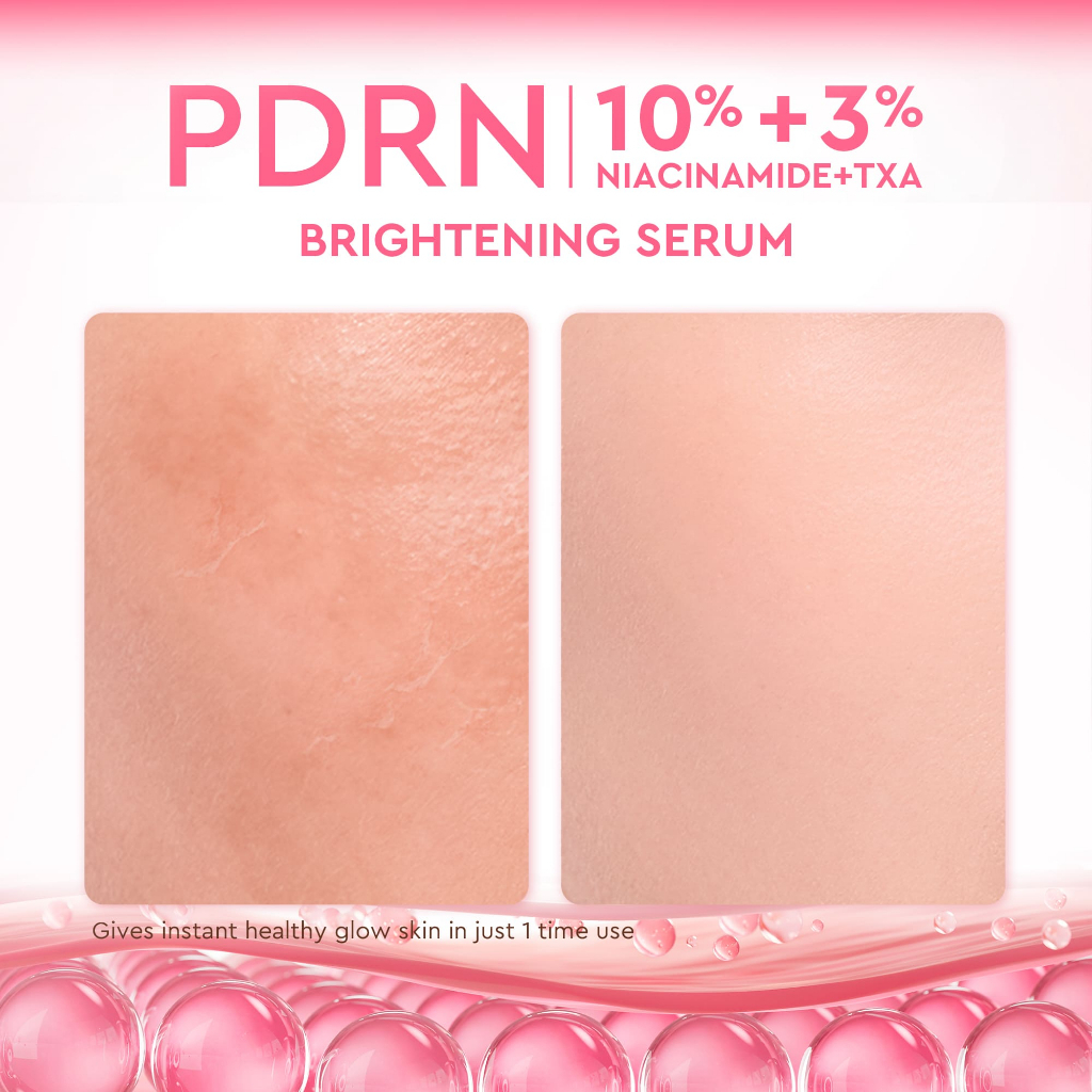 [NEW LAUNCH] Glad2Glow PDRN 10% NIACINAMIDE 3% TXA BRIGHTENING SERUM 3in1 Glow Brighten Dark Spots Plumps - View 2 of 3