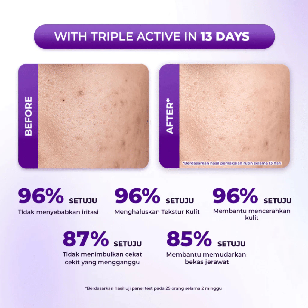 Facetology Triple Care 13.5% Total Acids Purple Ranger Peeling Treatment Serum with Glycolic Acid Exfoliating Formula - View 3 of 3