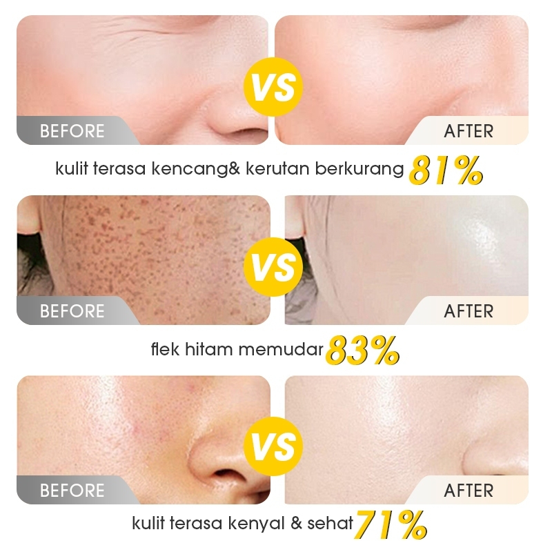 PureDew Anti-Wrinkle Glow Serum 20ml Brightening Essence for Skin Radiance, Anti-Aging Facial Serum Reduces Dullness, Evens Skin Tone, Whitening Skincare Treatment for Smooth Youthful Glowing Healthy Skin - View 3 of 3