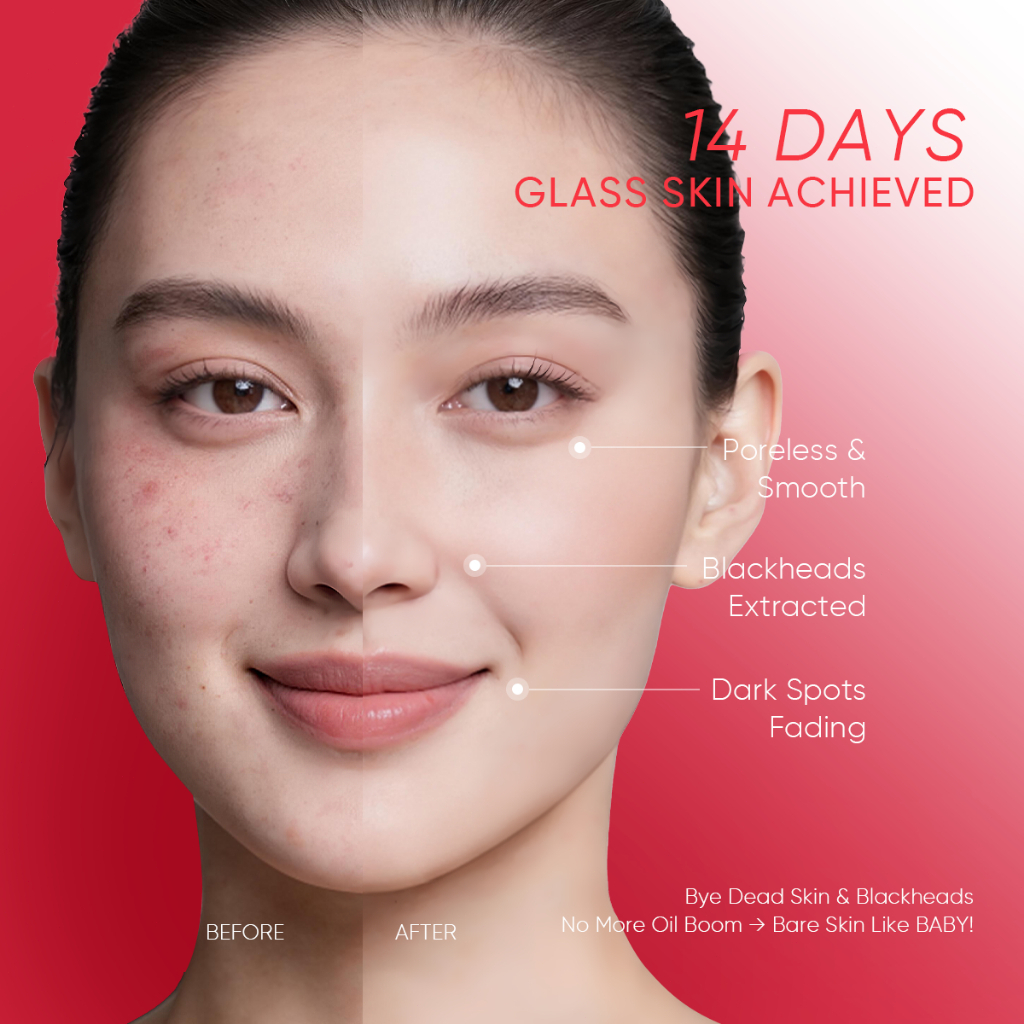 GMEELAN Centella 15% AHA Peeling Serum with 5X Vitamin C Brightening Exfoliating Facial Serum for Smooth Even Skin Tone, Gentle Skin Renewal Treatment for Radiant Healthy Glowing Complexion - View 2 of 3