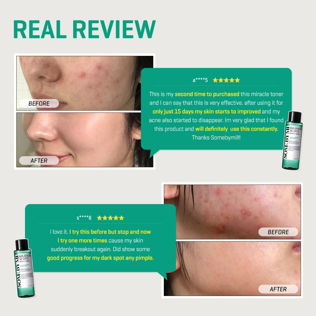 SOME BY MI AHA-BHA-PHA 30 Days Miracle Toner 30ml travel size mild exfoliating facial toner with Tea Tree essence helping unclog pores reduce acne and smooth skin texture gently for clearer complexion daily. - View 2 of 3