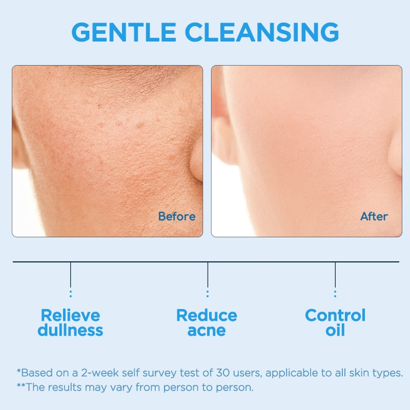 PAZIUM 5X Ceramide Gentle Cleanser for Oil Control, Anti-Acne Deep Cleansing Face Wash with Moisturizing Formula, Daily Skincare Solution for Fresh, Hydrated, Clear, Smooth, Balanced Skin, 80g Suitable for All Skin Types - View 3 of 3