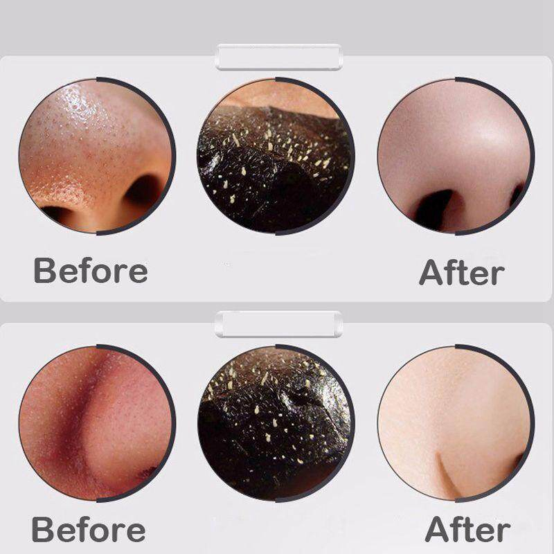 DR.RASHEL Black Mask Charcoal Peel-Off Face Mask Blackhead Remover Deep Clean Purifying Oil Control Acne Treatment Facial Mask for Nose T-Zone Pores Dirt Removal 60ml Skincare Formula - View 3 of 3