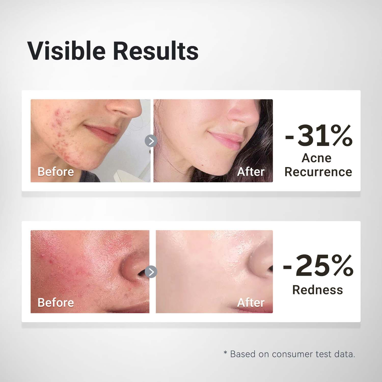 Dr.Leo 5% Panthenol Anti-Acne Soothing Water Gel Skin Barrier Repair Moisturizing Cream Calming Hydrating Gel Acne Care Face Cream Oil Control Sensitive Skin Treatment 50g Skincare Formula - View 3 of 3