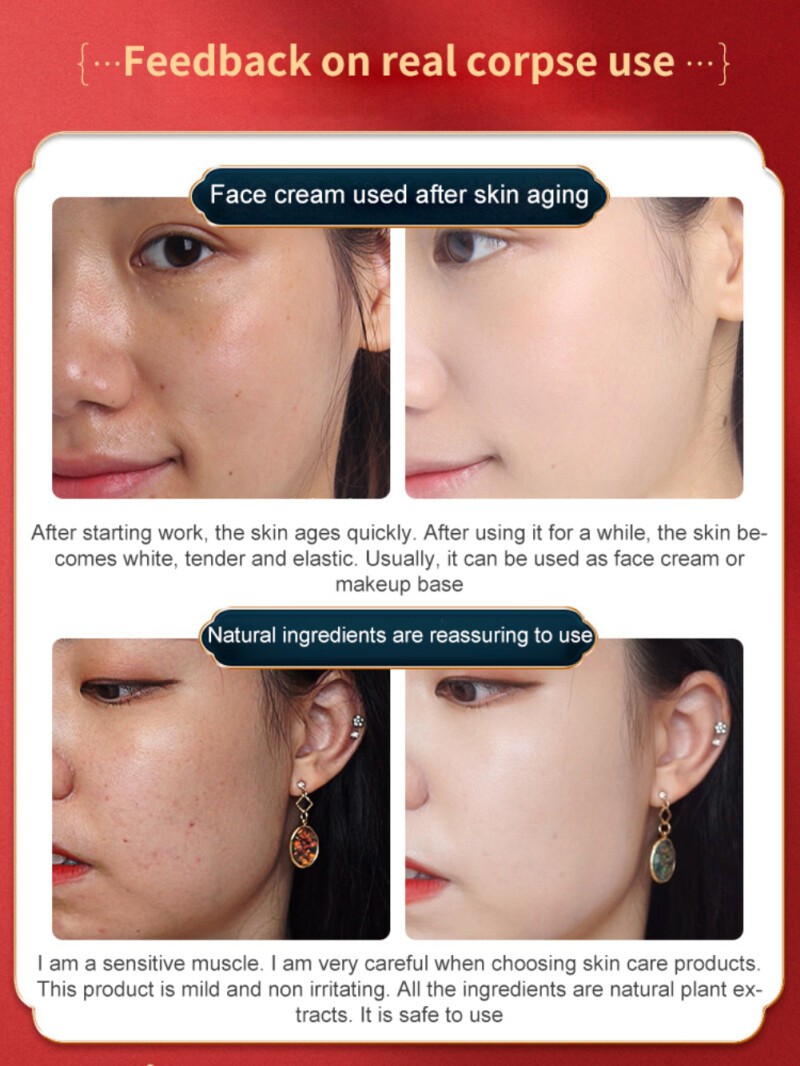 Tattielove Retinol Placenta Royal Dragon's Blood Balm Face Cream Anti Wrinkle Brightening Collagen Anti-aging Whitening Moisturizing Oil Control Face(FROM MALAYSIA) - View 2 of 3