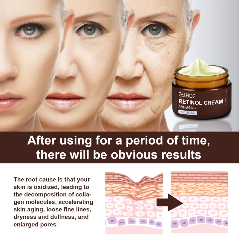 Tattielove eelhoe Natural Retinol cream Repair Face Cream Collagen Anti-Aging Remove Wrinkle Whitening - View 2 of 3