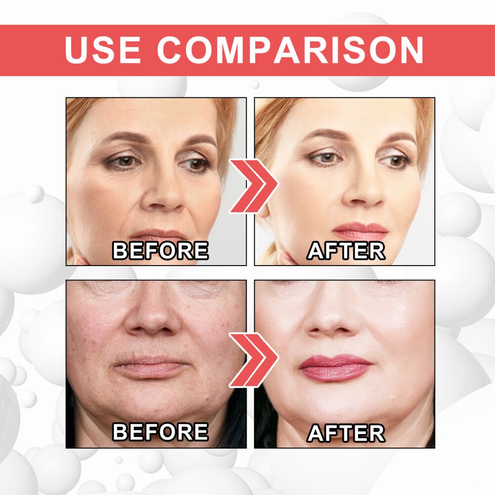 Tattielove Eelhoe Collagen Wrinkle Cream 30ml Collagen Boost Anti-Aging Serum(FROM MALAYSIA) - View 2 of 3