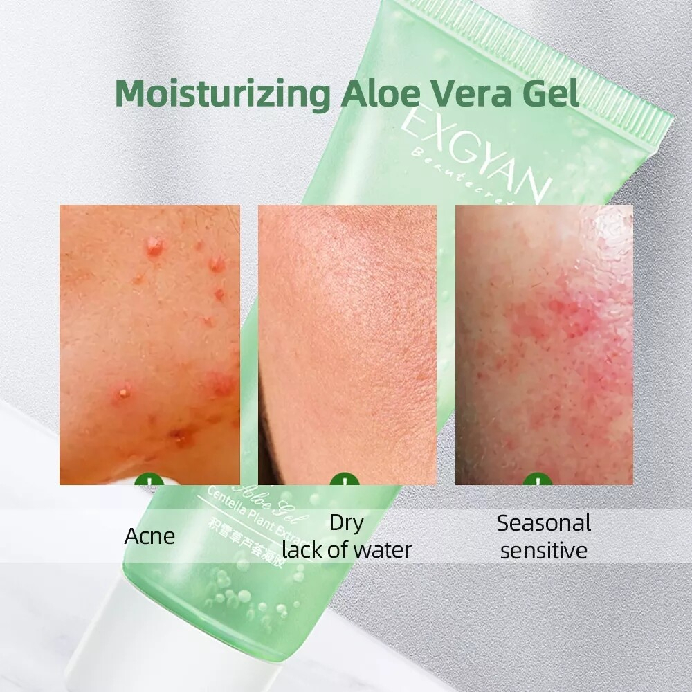 Foreverlily Aloe Vera Gel Moisturizing Skin Soothing Hydrating Pore Cleansing Facial and Body Care Essence for Soft Smooth Refreshed Healthy Looking Skin Daily Use - View 2 of 3