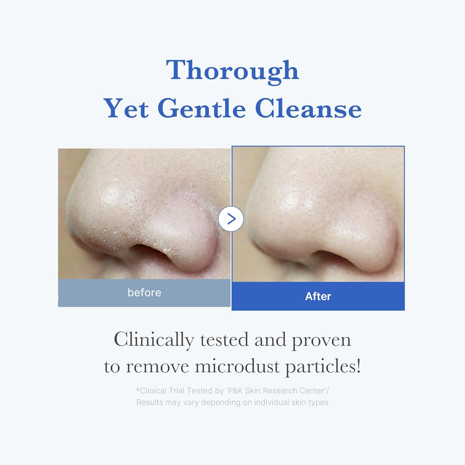 medicube Zero Foam Cleanser for Sensitive Skin - Sebum Control, Moisture Balance, and Pore Minimization | Korean Skincare - View 7 of 8