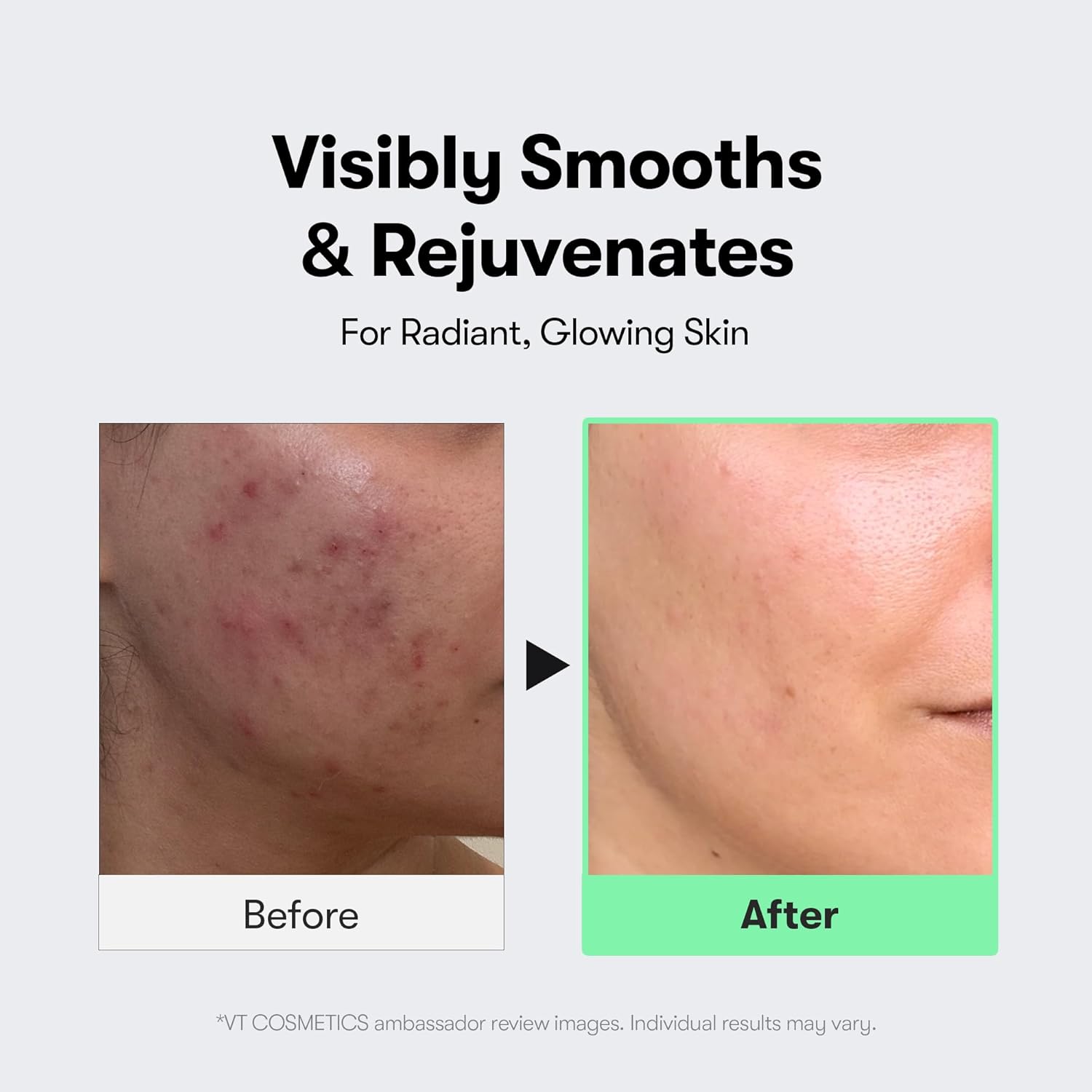 VT COSMETICS CICA Reedle Shot 300 | Advanced Night Exosome, Microneedling Serum, Centella Asiatica, Hyaluronic Acid, Propolis, Soft Skin, Regeneration, Glass Skin, Korean Skincare Booster (50ml) - View 5 of 8