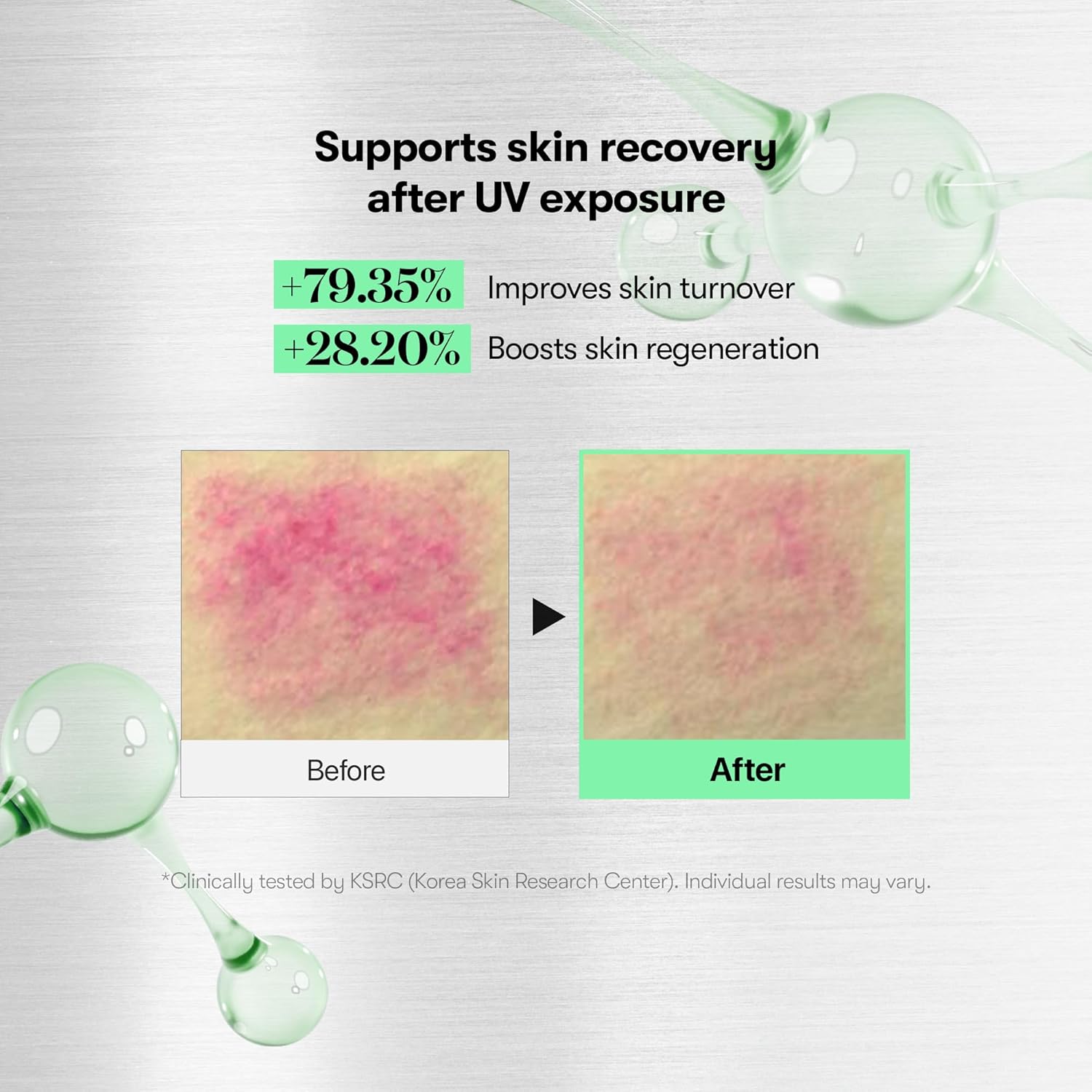 VT COSMETICS CICA Reedle Shot 700 | Spicule Microneedling Serum for Pore Care&Exfoliation, Exosome&Centella Asiatica for Glass Skin, Acne&Blemish Care, Korean Skin Booster (1 Fl Oz / 30ml) - View 5 of 7