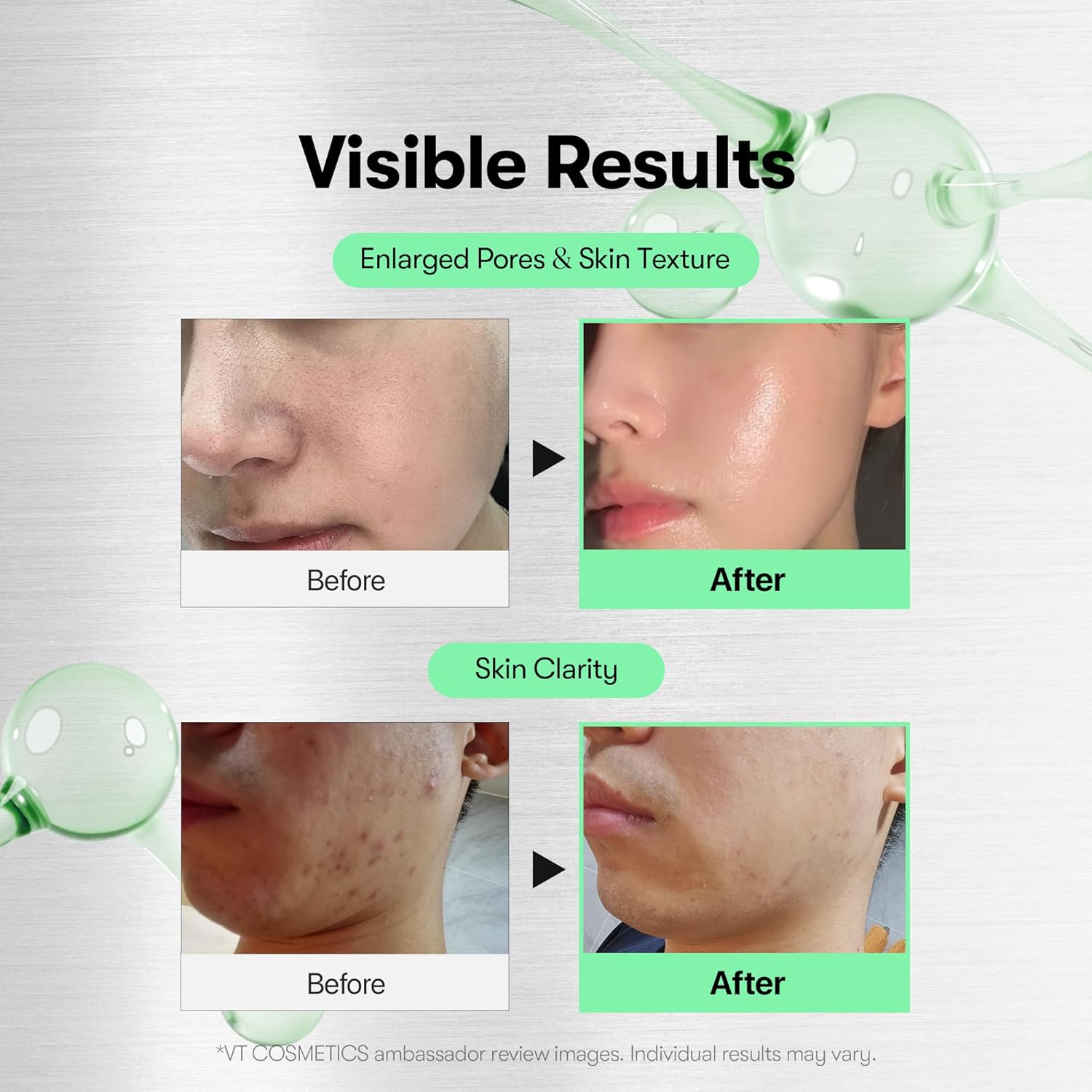 VT COSMETICS CICA Reedle Shot 700 | Spicule Microneedling Serum for Pore Care&Exfoliation, Exosome&Centella Asiatica for Glass Skin, Acne&Blemish Care, Korean Skin Booster (1 Fl Oz / 30ml) - View 6 of 7