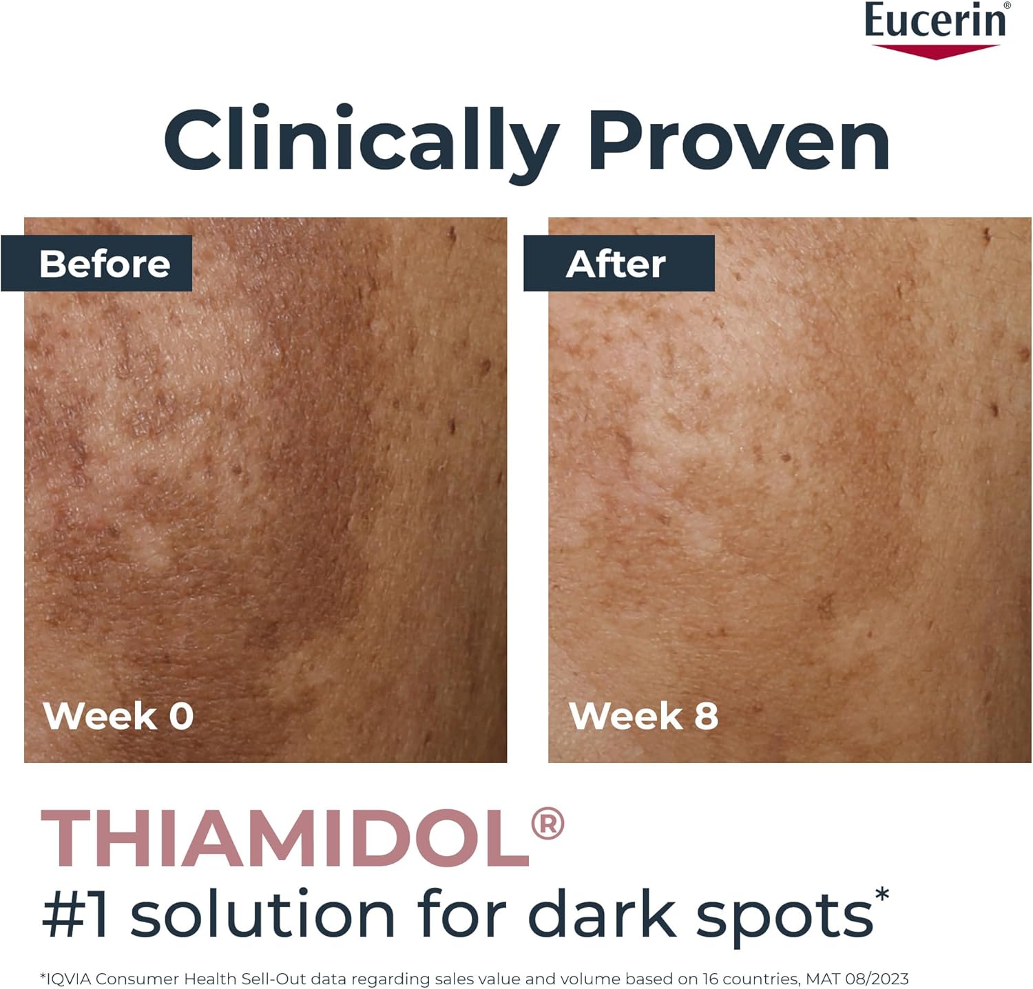 Eucerin Even Pigment Perfector Skin Perfecting Face Serum with Thiamidol and Hyaluronic Acid, Reduces Pigment Spots, Visible Radiance on the Skin, Moisturizer for All Skin Types, 30ml - View 8 of 9