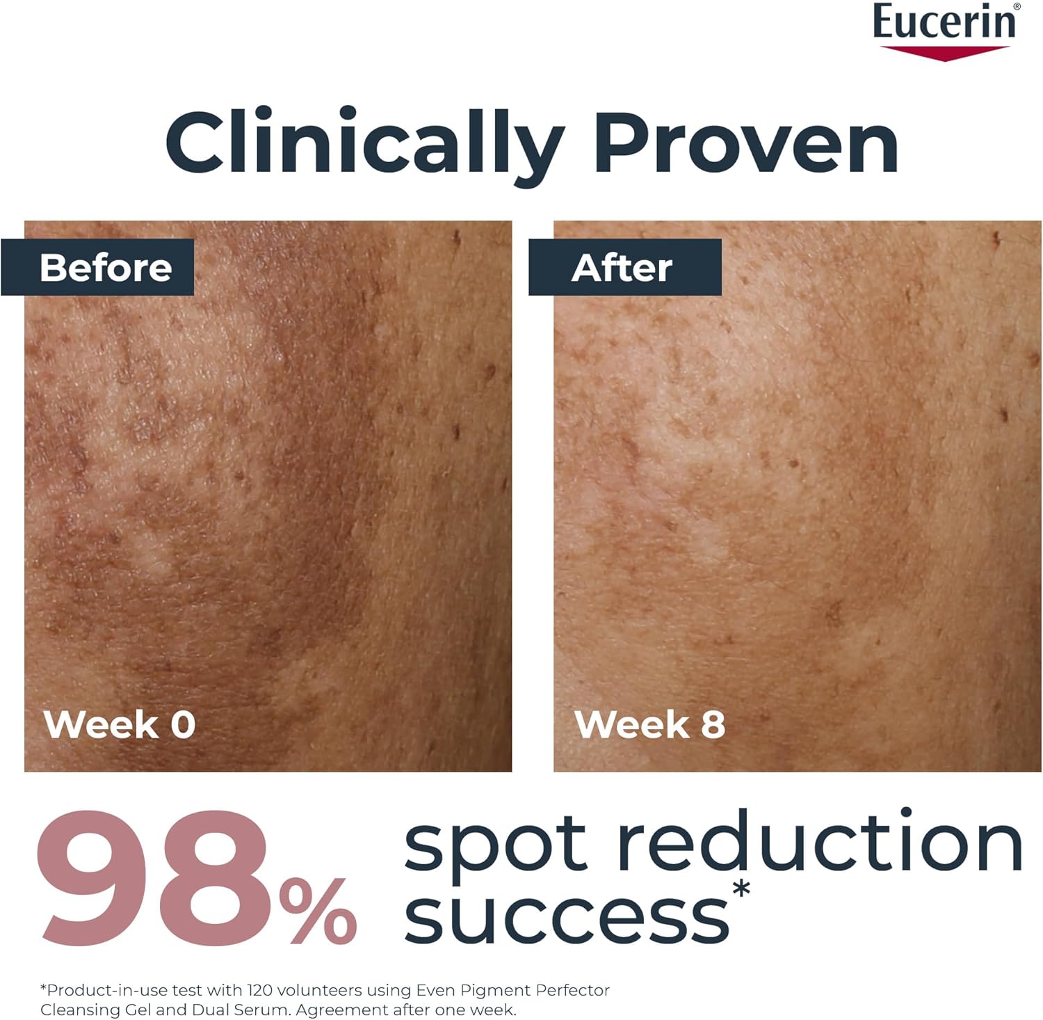Eucerin Even Pigment Perfector Face Day Cream with Thiamidol, UVA & UVB Sun Protection, SPF 30, Reduces Pigment Spots & Prevent Their Reappearance, Instant Moisturizer for All Skin Types, 50ml - View 8 of 9