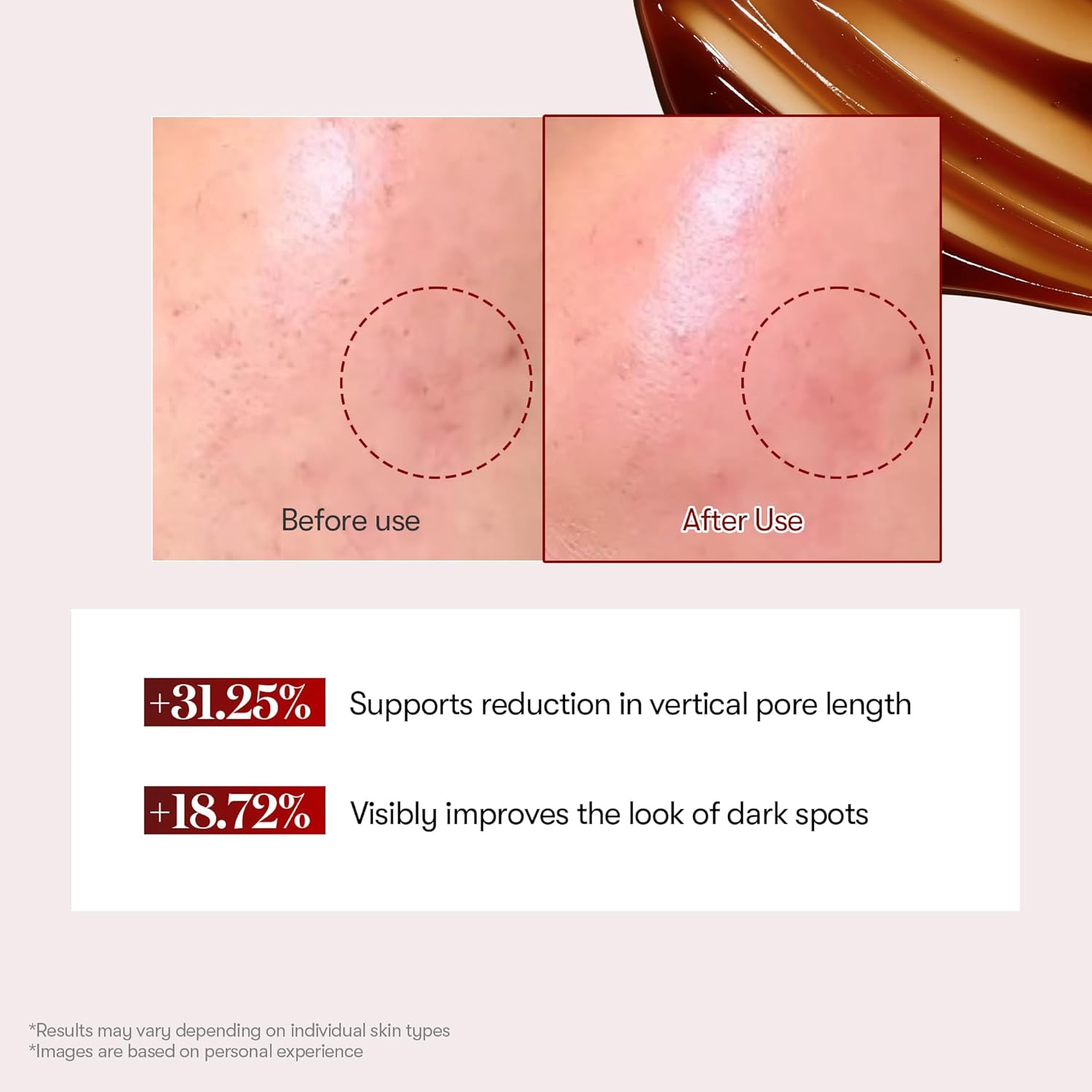 VT COSMETICS Red Booster Reedle Shot 100, Microneedling Serum with Dragon’s Blood, Exosome, Soothing Relief Serum for Irritated, and Sun-Stressed Skin, Scalp Care, Korean Skincare 1.69 fl oz (50ml) - View 5 of 7