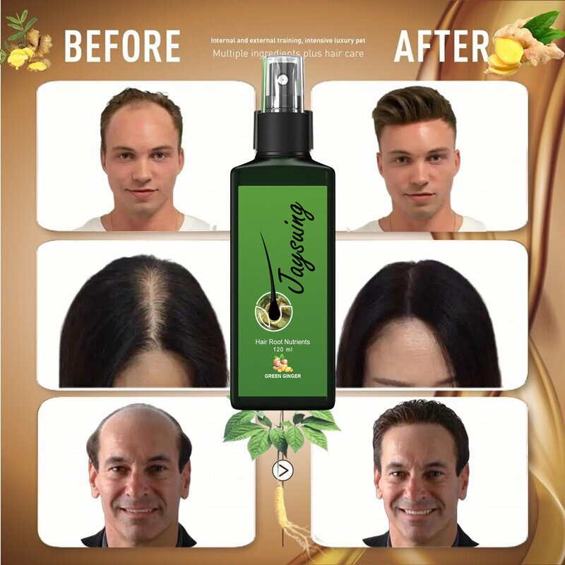 Jaysuing Ginger Hair Growth Spray Serum 1pcs | Natural Anti Hair Loss Treatment | Hair Growth Scalp Serum for Men & Women | Helps Strengthen Roots, Reduce Hair Fall and Support Thicker Hair - View 2 of 3