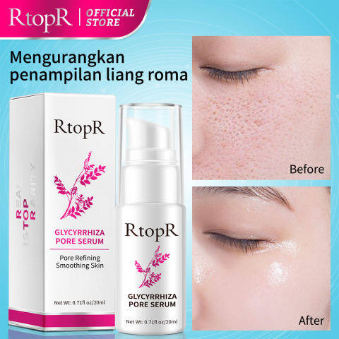RtopR Glycyrrhiza Face Pore Repair Serum 30ml | Collagen Anti-Wrinkle Whitening Face Serum | Oil Control Hydrating Skin Care | Helps Shrink Pores, Smooth Skin and Improve Radiant Looking Complexion - View 2 of 3
