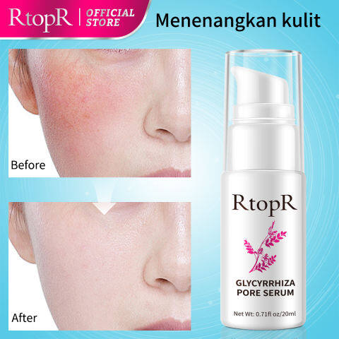 RtopR Glycyrrhiza Face Pore Repair Serum 30ml | Collagen Anti-Wrinkle Whitening Face Serum | Oil Control Hydrating Skin Care | Helps Shrink Pores, Smooth Skin and Improve Radiant Looking Complexion - View 3 of 3
