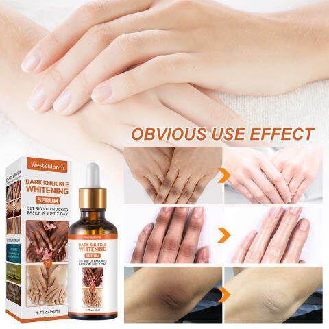 West&Month Dark Knuckle Whitening Serum 50g | Knee & Ankle Brightening Skin Care Cream | Moisturizing Nourishing Formula | Helps Improve Uneven Tone, Smooth Rough Skin and Restore Radiant Looking Areas - View 2 of 3