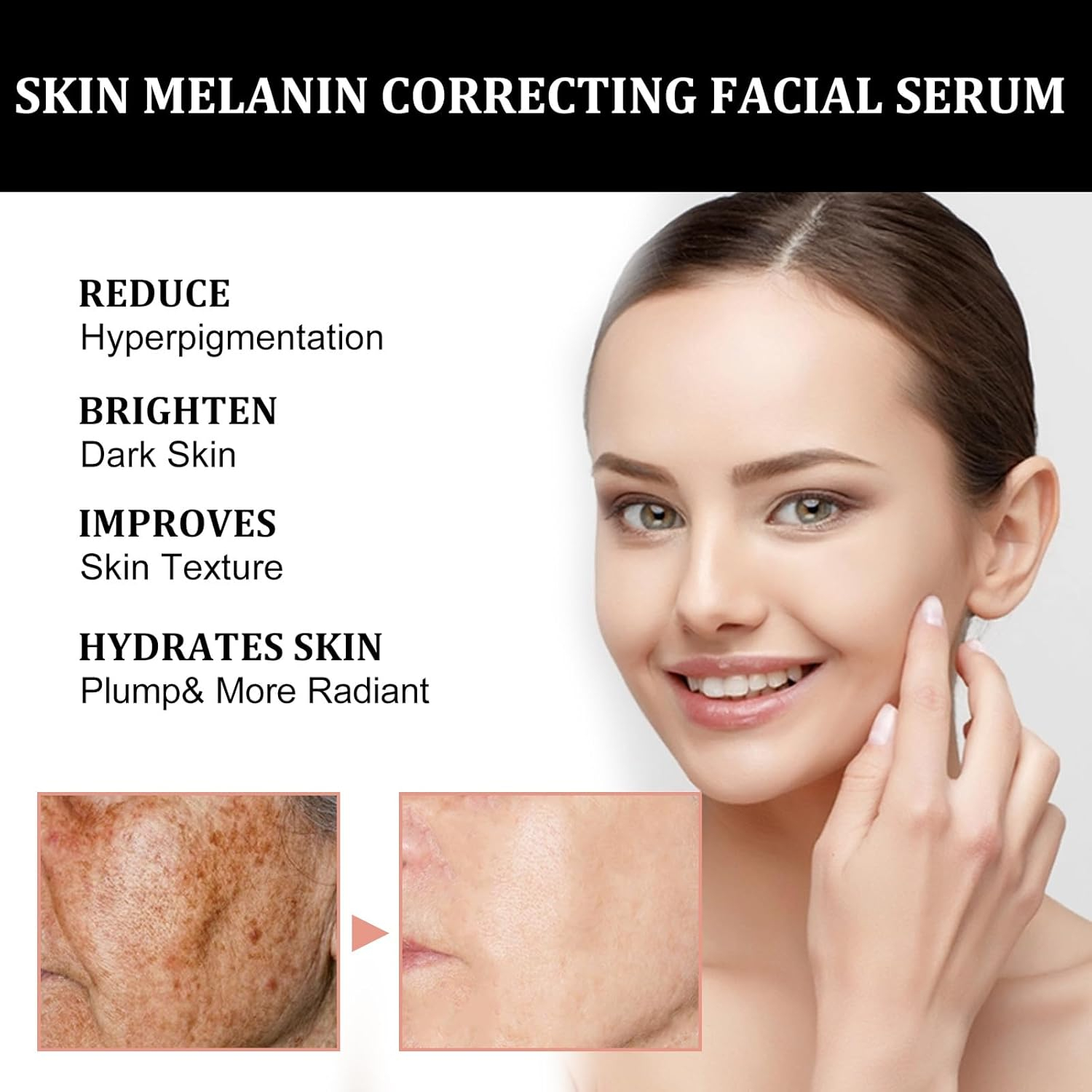 Melanin Correcting Facial Serum | Dark Spot Correcting Skin Care Serum | Brightening Face Treatment Essence | Helps Improve Uneven Tone, Reduce Dark Spots and Support Clear Radiant Looking Skin Daily Use - View 3 of 3