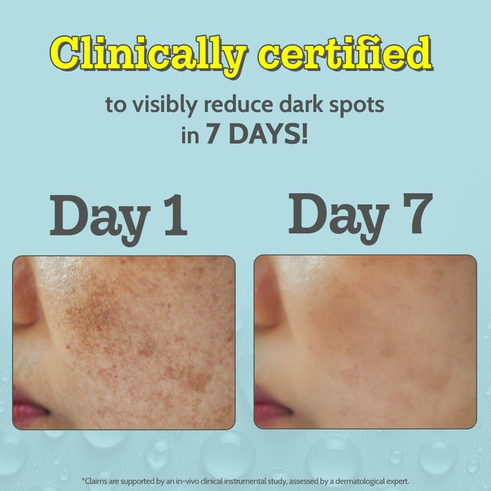 Chemist At Play 10% Vitamin C Serum 10ml | Brightening Facial Serum for Glowing Skin | Antioxidant Skin Care Essence | Helps Improve Dullness, Nourish Skin and Support Smooth Radiant Looking Complexion - View 2 of 3