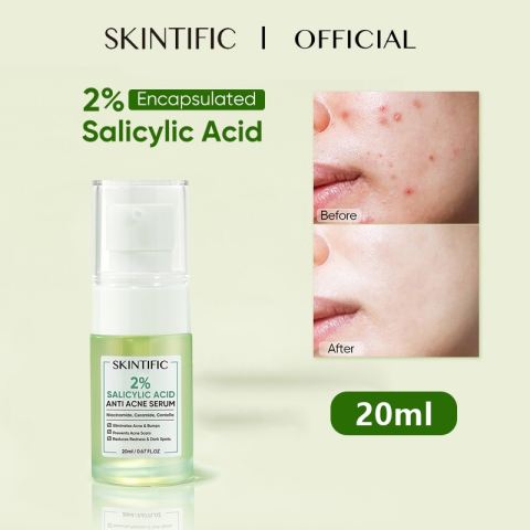 SKINTIFIC 2% Salicylic Acid Anti Acne Serum 20ml | Spot Treatment Brightening Face Serum | Acne & Scar Care | Helps Clear Breakouts, Refine Pores and Support Healthy Skin Barrier Repair - View 2 of 3