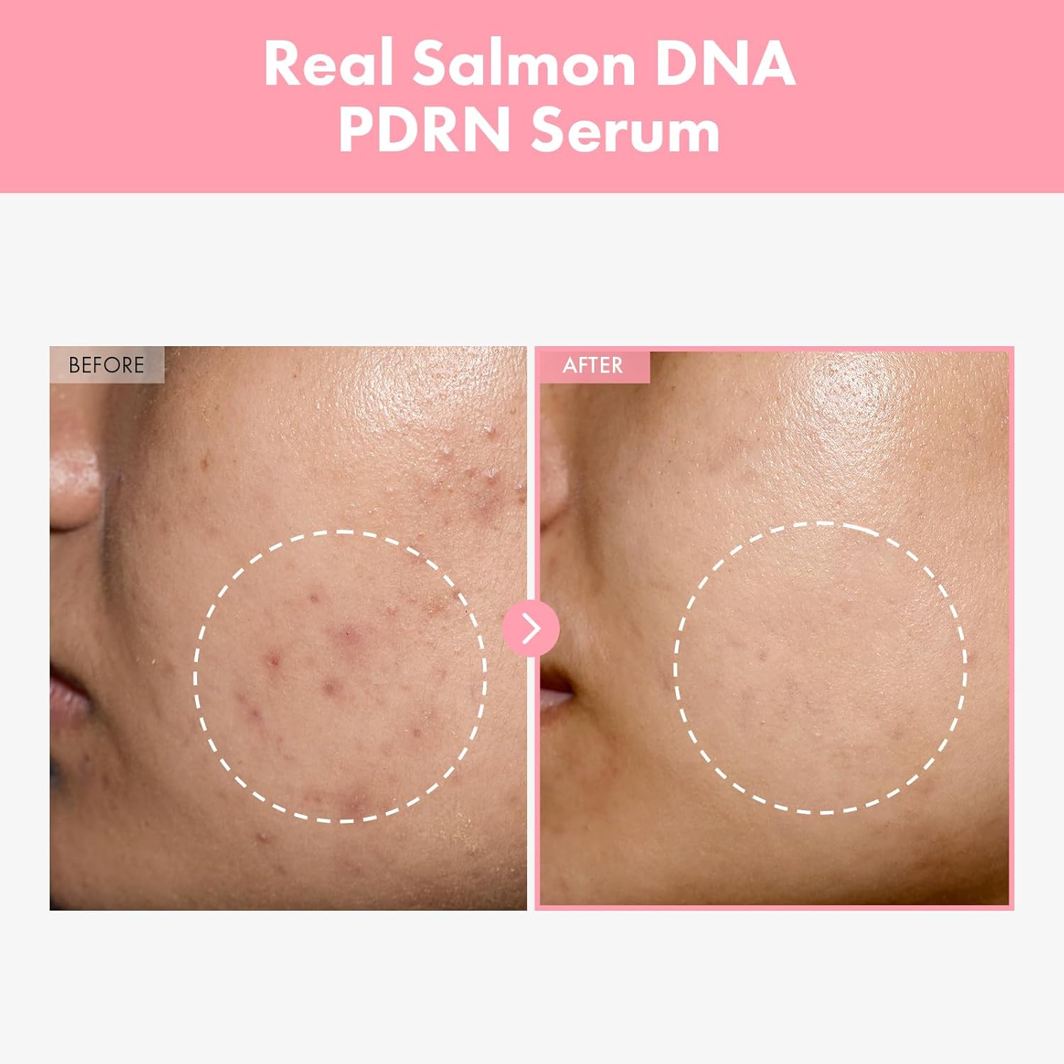 TOSOWOONG Pink Peptide 12 PDRN Serum With Salmon DNA PDRN 10,320ppm, 12 Peptides, Niacinamide, Skin Glow, Hydrating, Moisturizing, Elasticity Support, Even Skin Tone, Korean Skincare, 33ml, 1.11 fl.oz - View 5 of 5