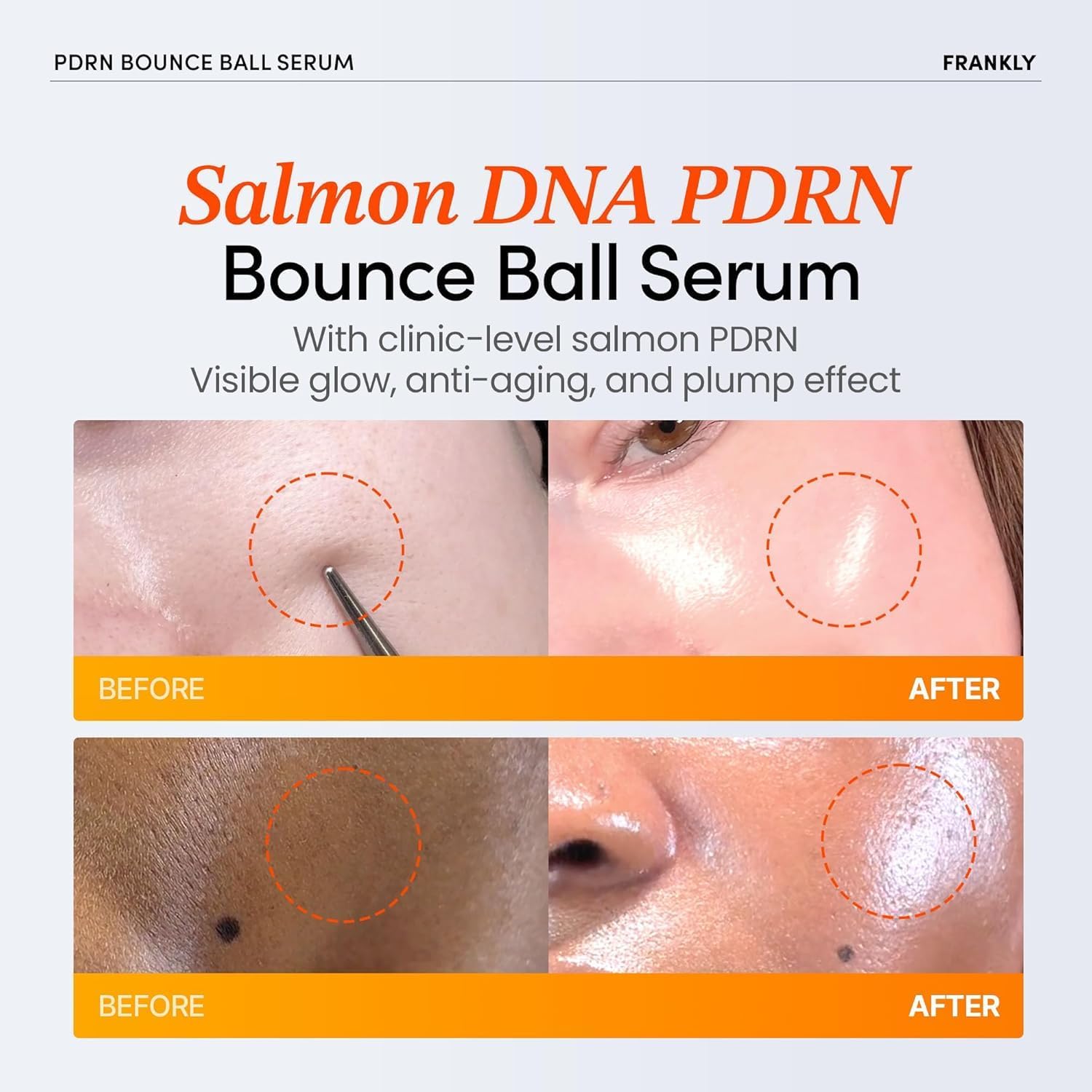 FRANKLY Salmon PDRN Bounce Ball Serum – Skin Repair PDRN Salmon DNA Serum for Post Microneedling Recovery, Redness & Damaged | Glass Skin Korean Skincare | Lightweight, Non Sticky | 1.01 fl oz - View 7 of 8
