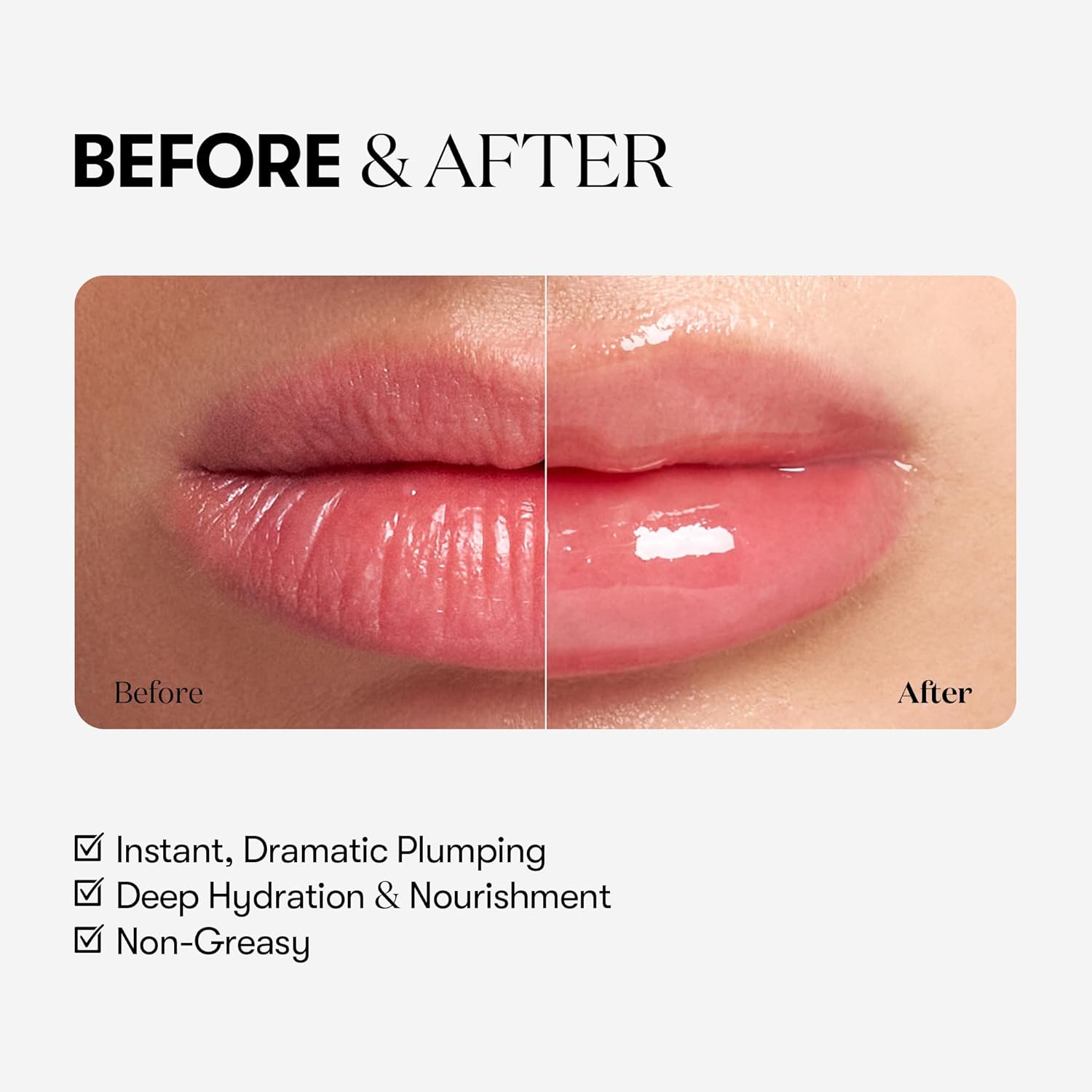VTCOSMETICS Reedle Shot Lip Plumper (Expert), Moisturizing, Transparent, Lip Gloss, Fragrance-free, Korean Cosmetics, 0.15 oz (4.3 g), - View 5 of 7