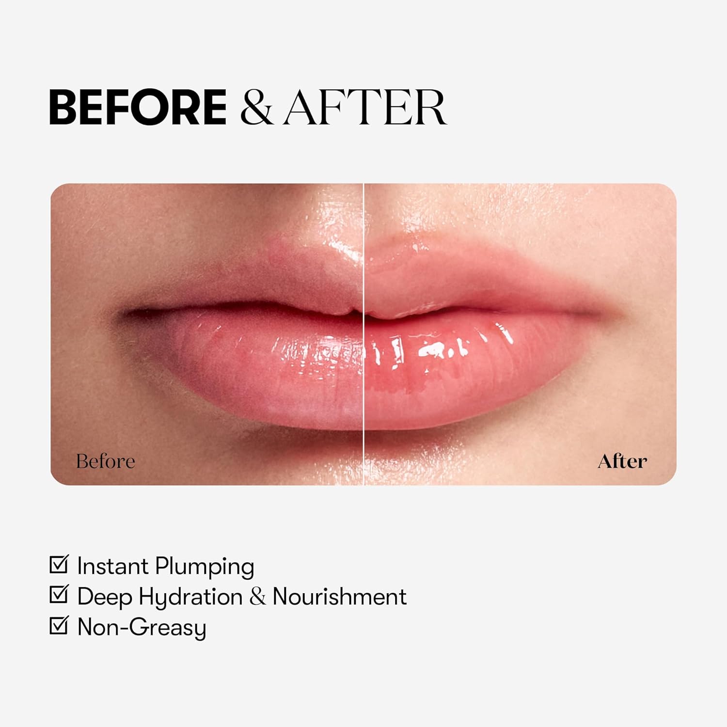 VT COSMETICS Reedle Shot Lip Plumper (Beginner), Hydrating & Volumizing Clear Lip Gloss, Microneedling Effect & Hyaluronic Acid for Fuller, Smoother Lips, 0.15 oz (4.3 g) - View 4 of 7