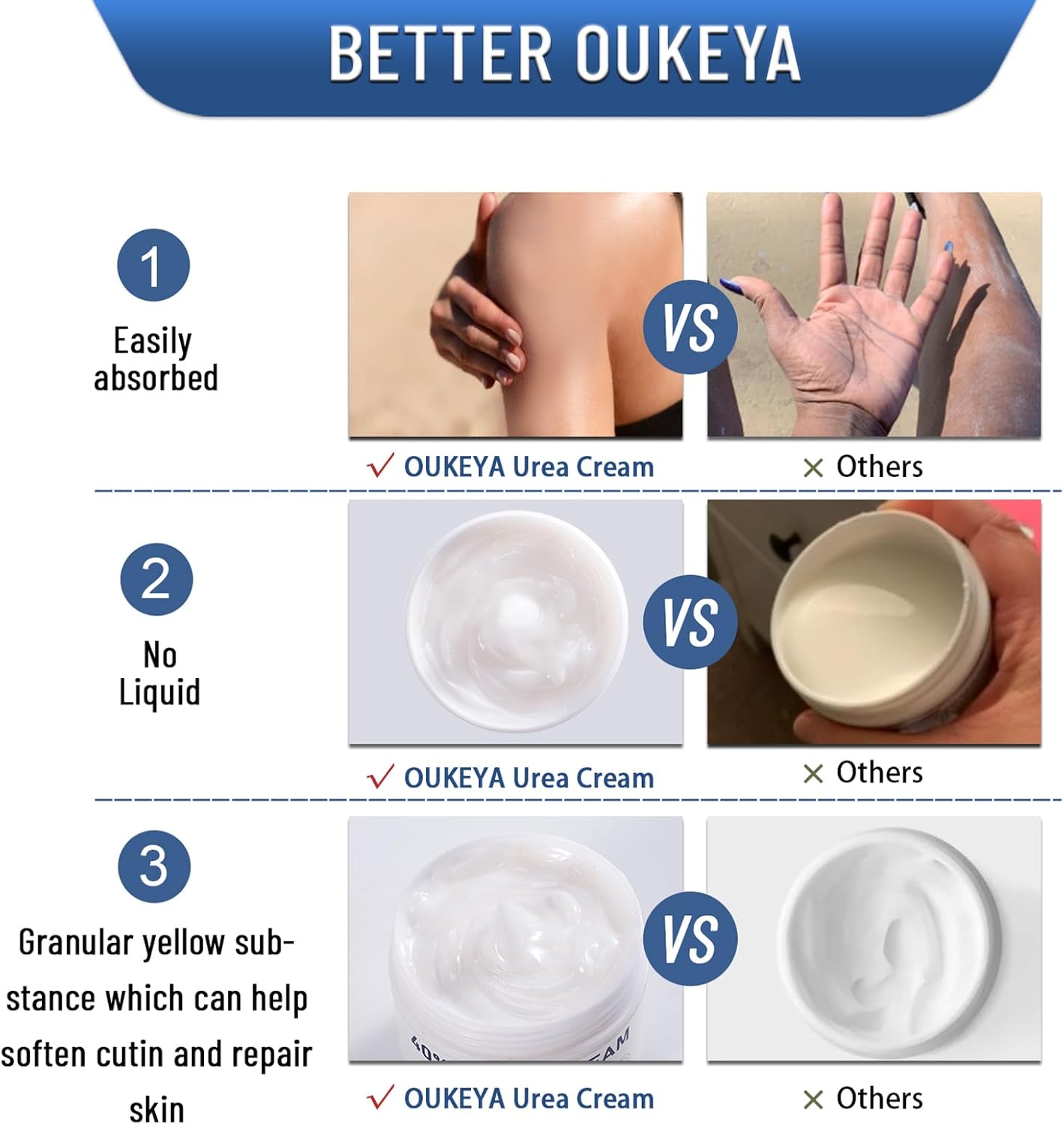 OUKEYA Urea Cream 40 Percent, Urea Foot & Hand Cream for Cracked Heels and Dry Skin, Urea Lotion for Deep Moisturizing, Callus Remover Nourishes Soften, Foot Moisturiser for Women&Men,Maximum Strength - View 5 of 6
