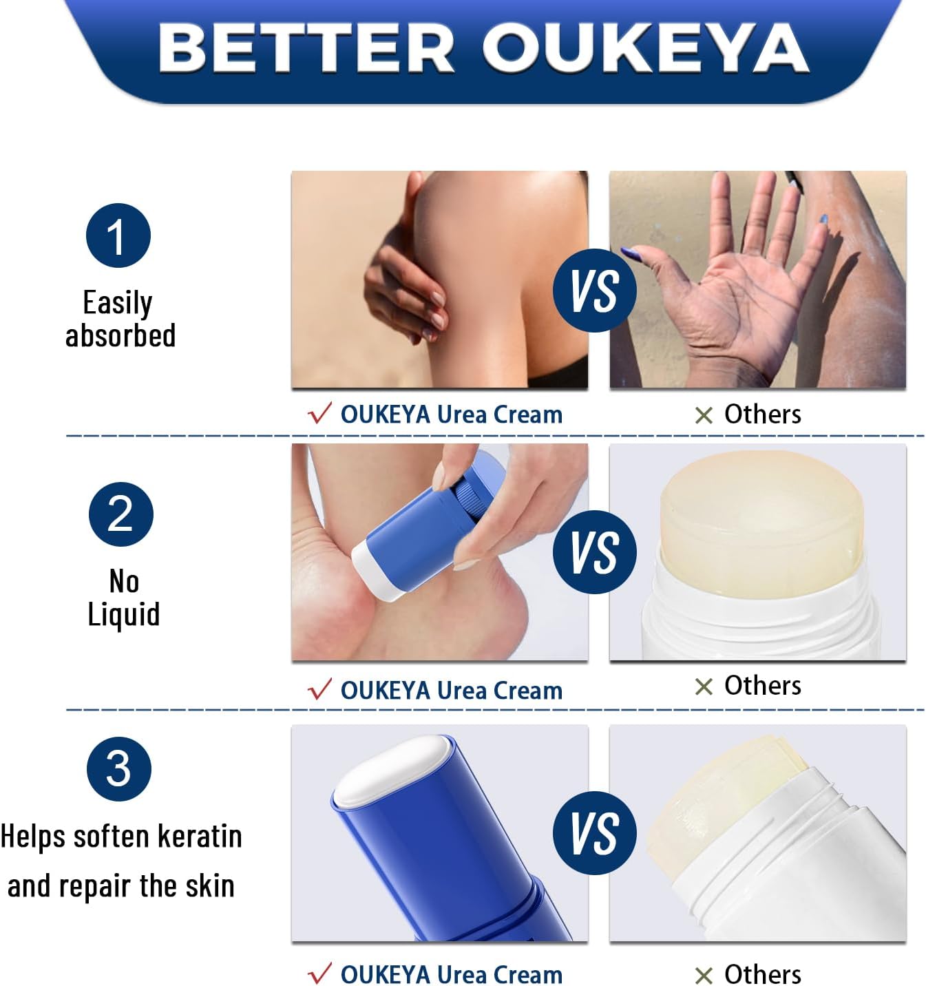 OUKEYA Urea Cream Stick 40 Percent Foot & Hand Cream for Cracked Heels and Dry Skin Deep Moisturizing Callus Remover Nourishes Soften for Women&Men,Maximum Strength - View 4 of 8