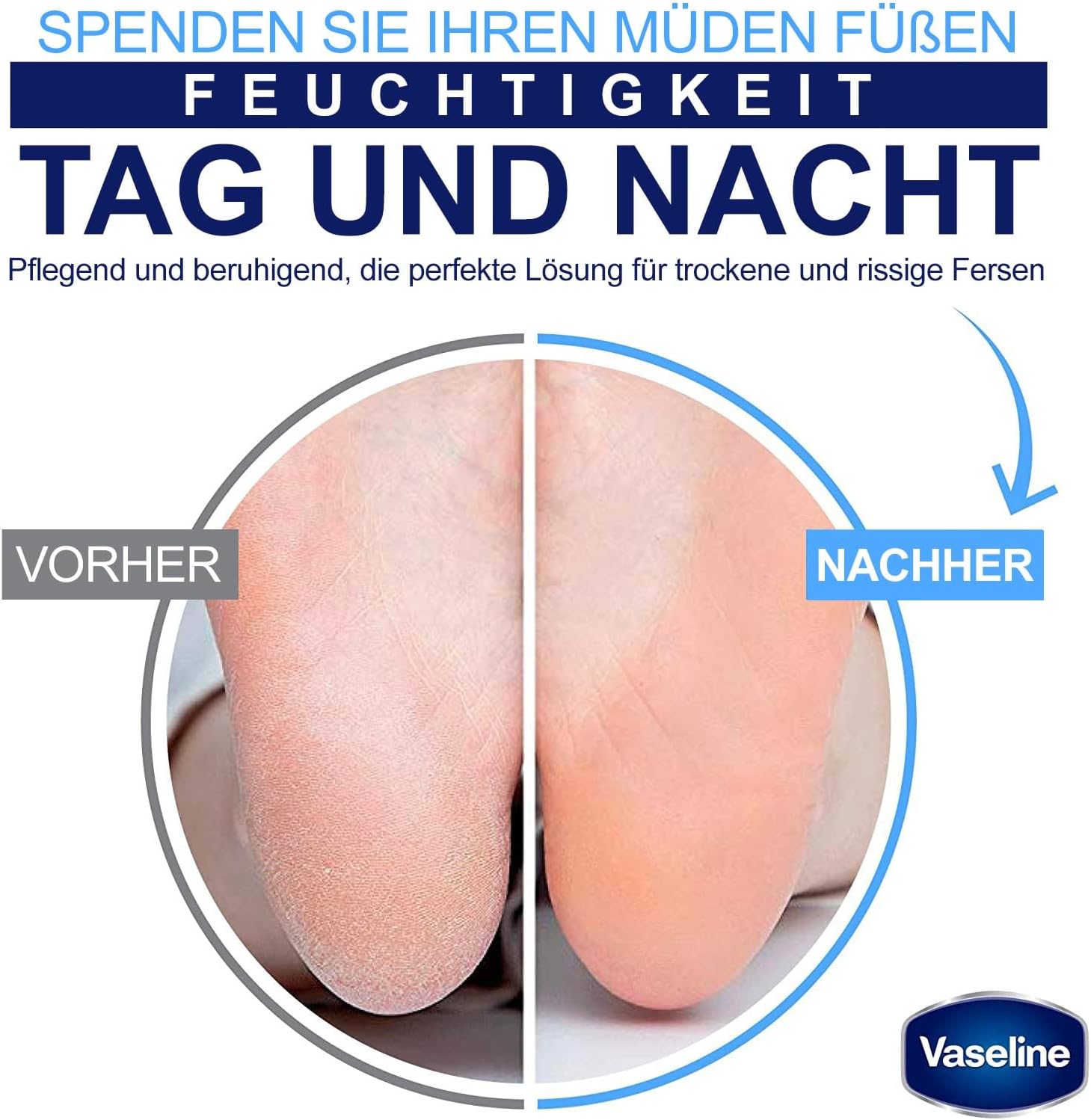 Vaseline Deep Moisture Foot Cream | Intensive Hydration for Dry & Cracked Feet | Non-Greasy Repair Care, 55 g - View 3 of 5