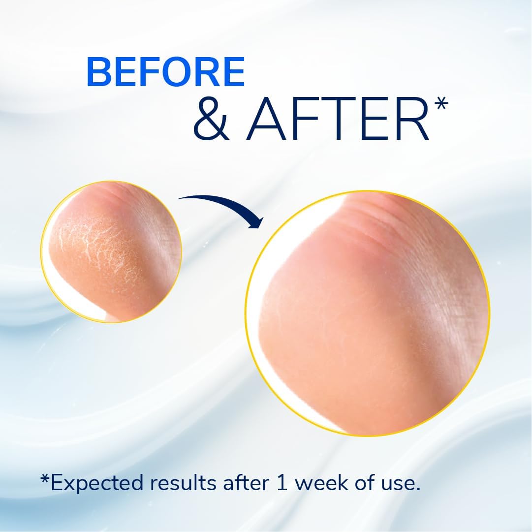 Dr. Scholl'S Cracked Heel Repair Balm 2.5oz, with 25% Urea for Dry Cracked Feet, Heals and Moisturizes for Healthy Feet - View 7 of 8