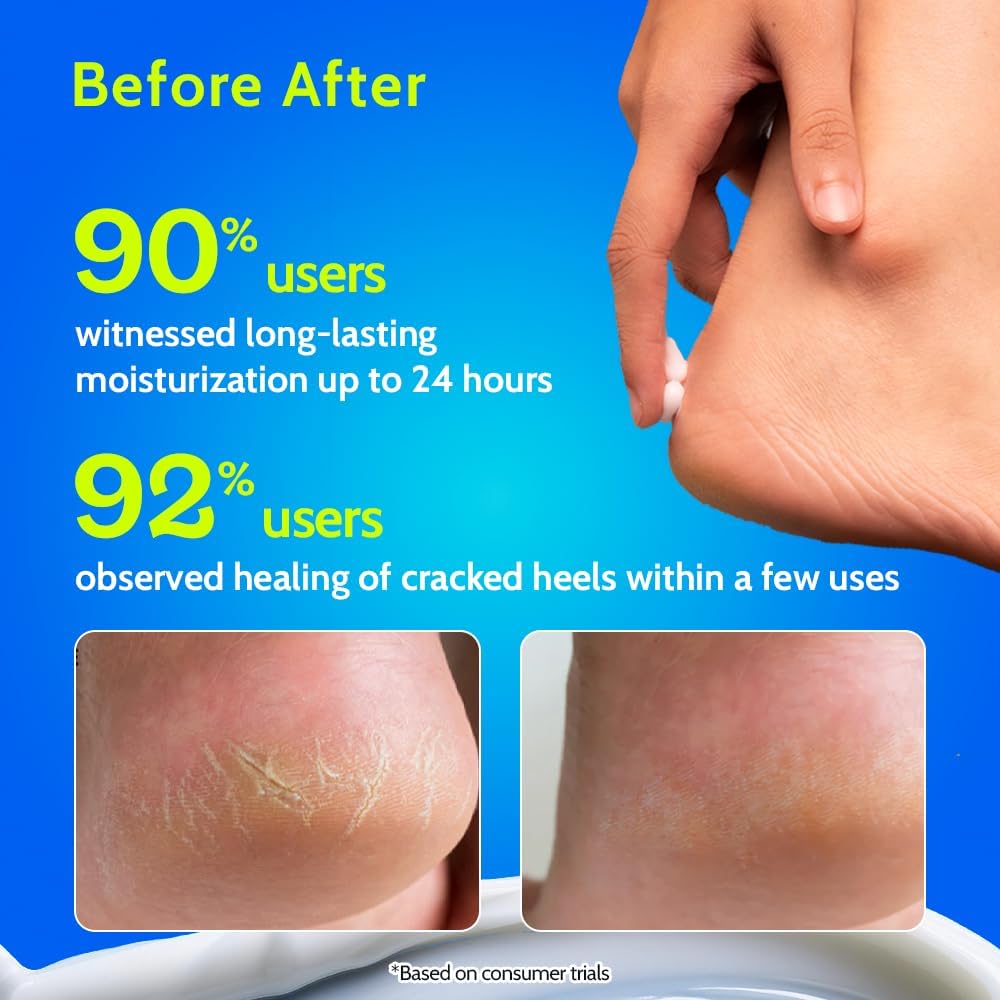 Chemist at Play Foot Cream for Cracked Heels & Diabetic Foot | Up to 24 hours of Moisturization | 10% Urea & Natural AHAs | Nourishment & Hydration | For Dry & Cracked Feet | Lightweight | 50g - View 2 of 6